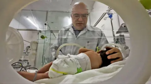 Doctor in white coat holds the head of a baby in an incubator.