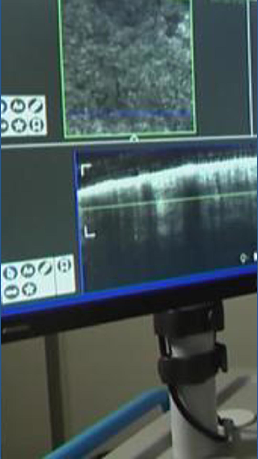 Rising Cancer Rates in Iowa Linked to Lifestyle and Farming Factors, Experts Say